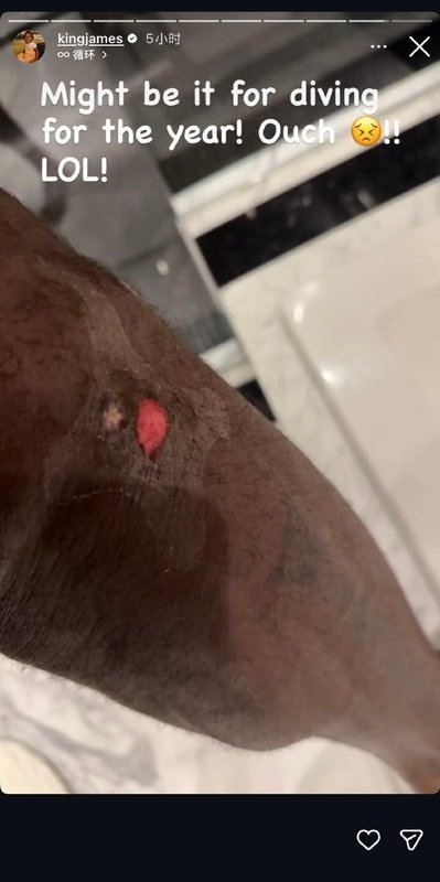  勒布朗拼尽全力倒地抢球；腿伤照片曝光后球迷心疼不已。 体育新闻